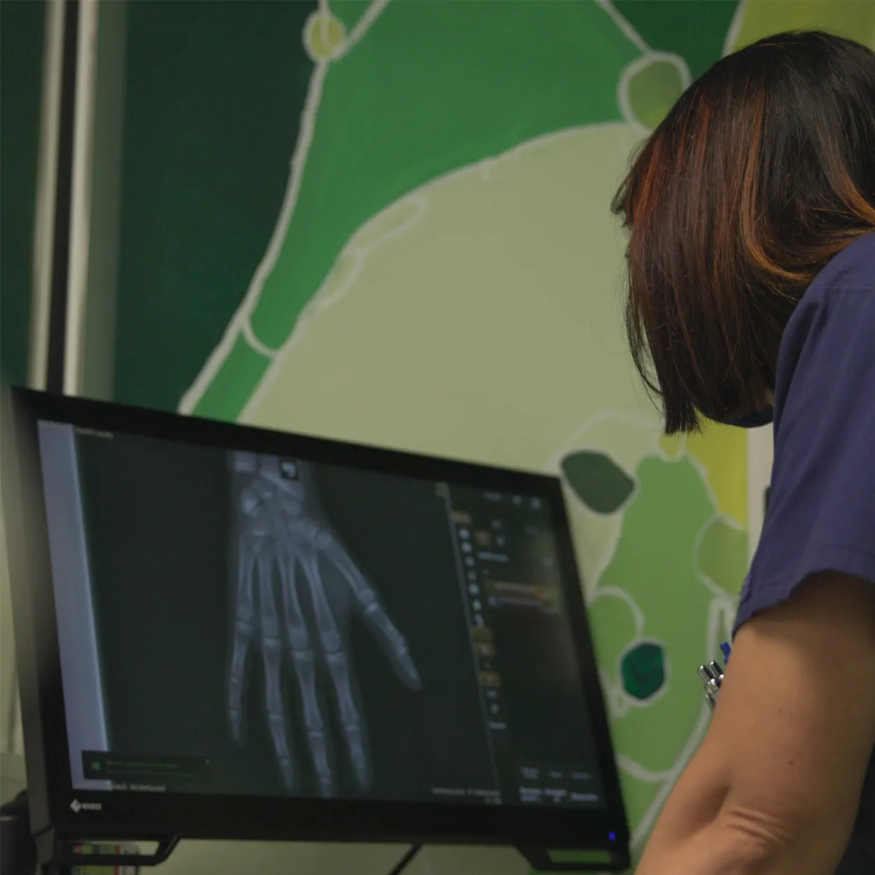 Plateau technique d'un CMSI — équipements d'imagerie médicale sur place